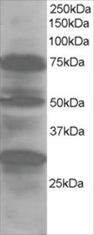 Anti-LMO7/FBXO20 antibody produced in goat