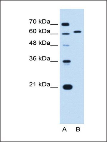 Anti-LMNB2 antibody produced in rabbit