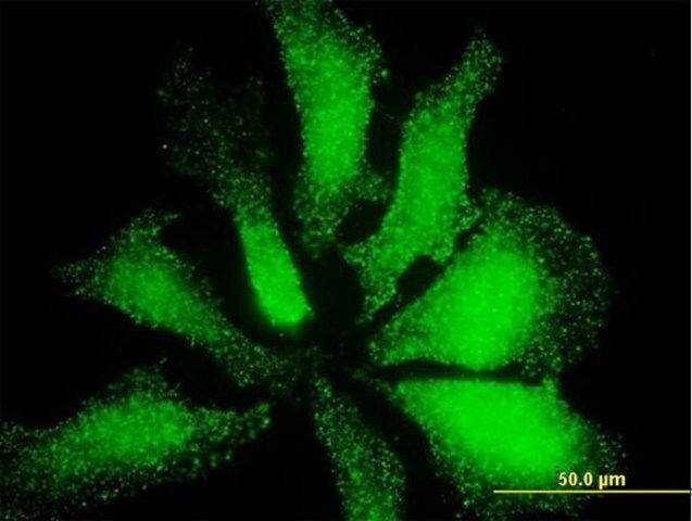 ANTI-LMO3 antibody produced in mouse