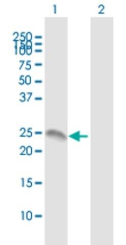 Anti-LOC389289 antibody produced in mouse