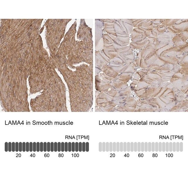 Anti-LAMA4 antibody produced in rabbit