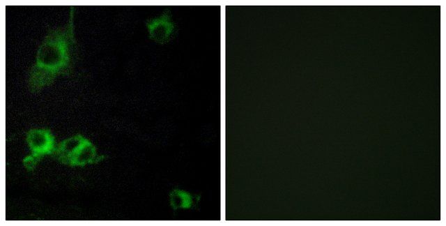 Anti-LAMA1 antibody produced in rabbit