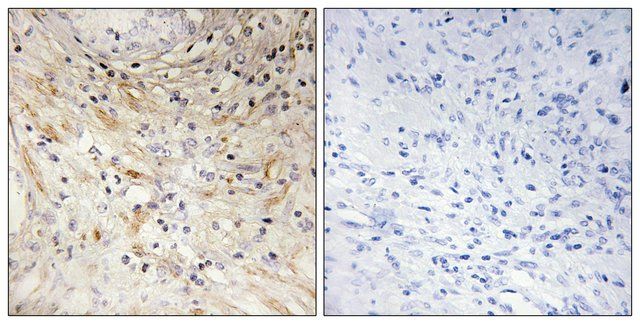 Anti-LAMB3 antibody produced in rabbit