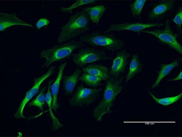 Anti-LAMB1 antibody produced in mouse