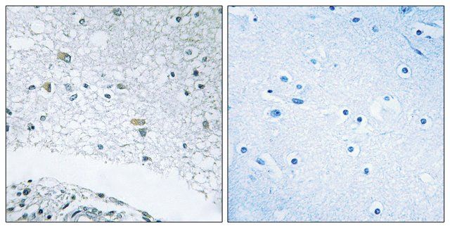 Anti-LAMC3 antibody produced in rabbit