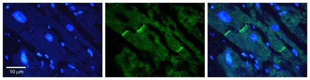 Anti-LASS2, (N-terminal) antibody produced in rabbit