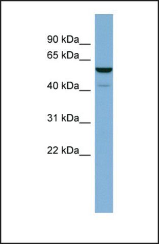 Anti-LAP3, (N-terminal) antibody produced in rabbit