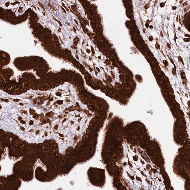 Anti-LARP4 antibody produced in rabbit