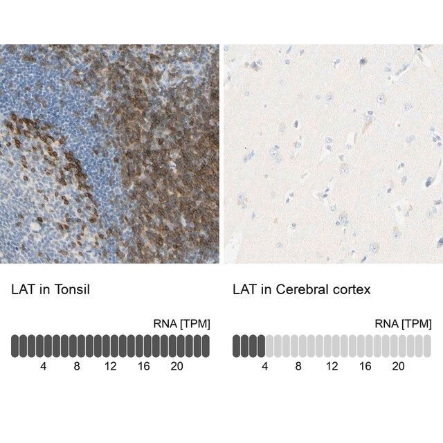 Anti-LAT antibody produced in rabbit