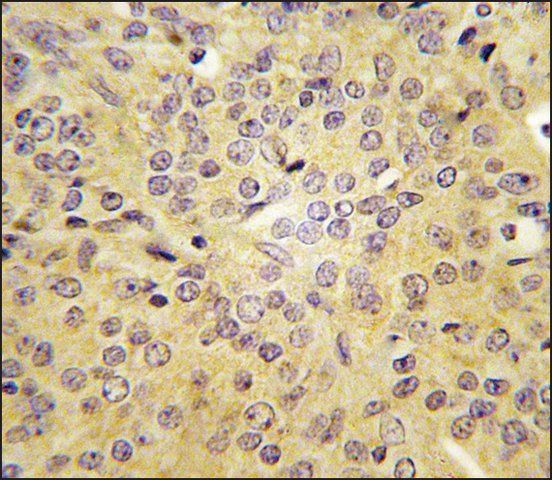 Anti-LARS (C-term) antibody produced in rabbit