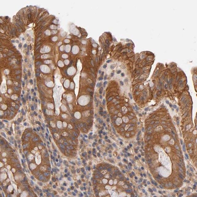 Anti-LAMTOR2 antibody produced in rabbit