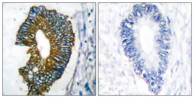 Anti-Keratin 18 antibody produced in rabbit