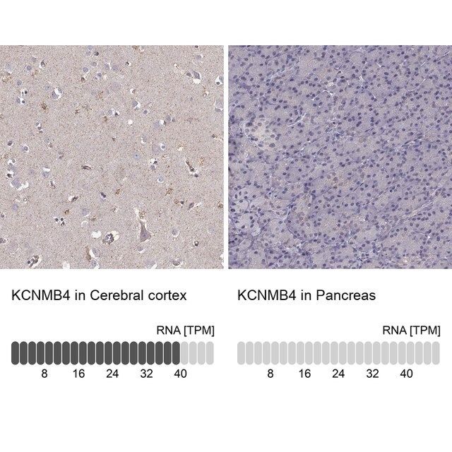 Anti-KCNMB4 antibody produced in rabbit