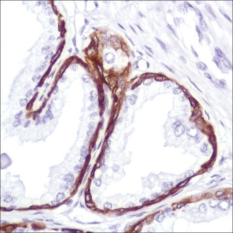 Anti-Keratin 5 antibody, Rabbit monoclonal