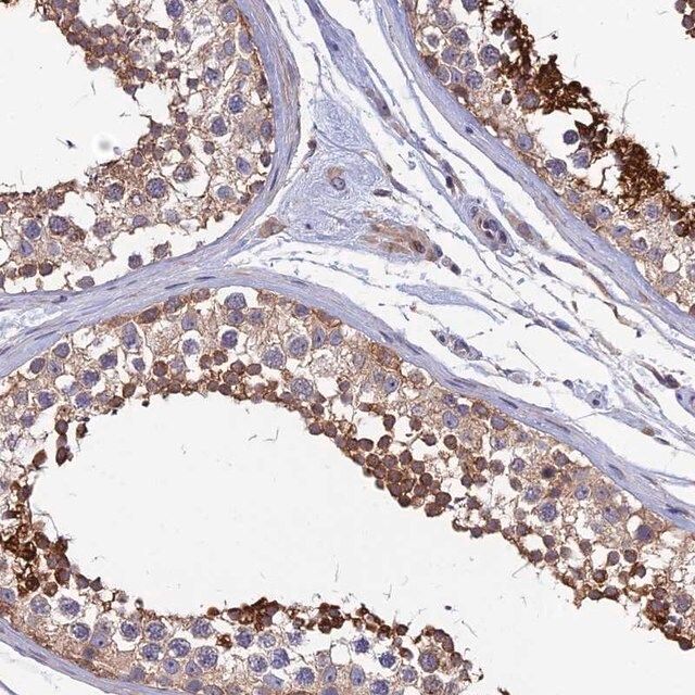 Anti-KIAA1211 antibody produced in rabbit