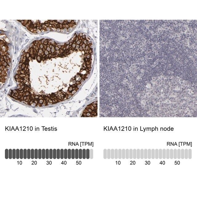 Anti-KIAA1210 antibody produced in rabbit