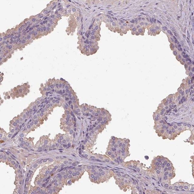 Anti-ISLR antibody produced in rabbit