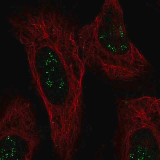 Anti-ISPD antibody produced in rabbit