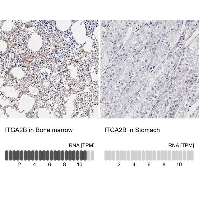 Anti-ITGA2B antibody produced in rabbit