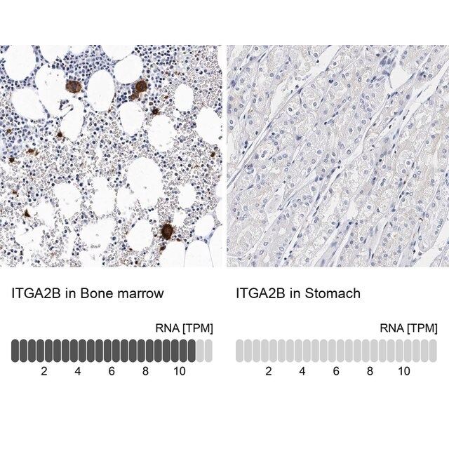 Anti-ITGA2B antibody produced in rabbit