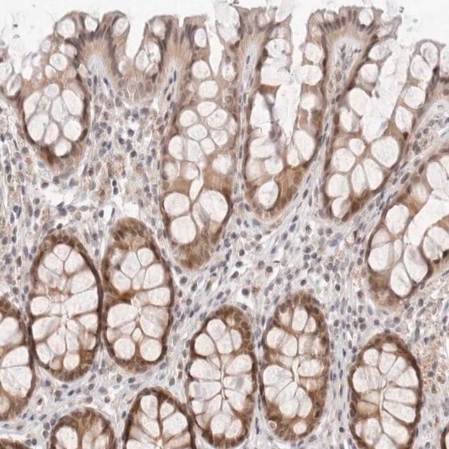 Anti-ITGB3BP antibody produced in rabbit