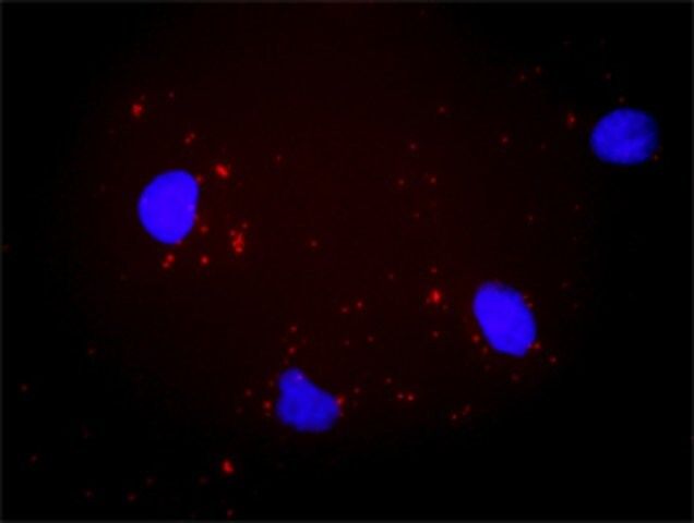 Anti-ITGAV antibody produced in mouse