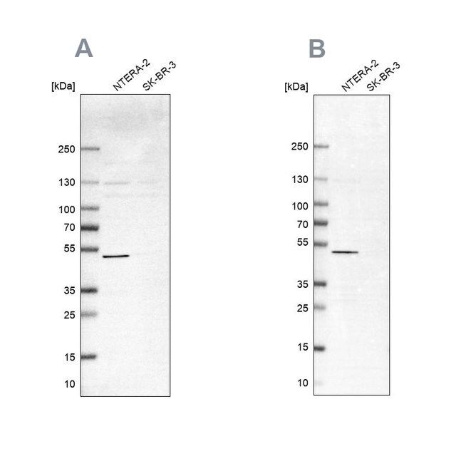 Anti-IST1 antibody produced in rabbit