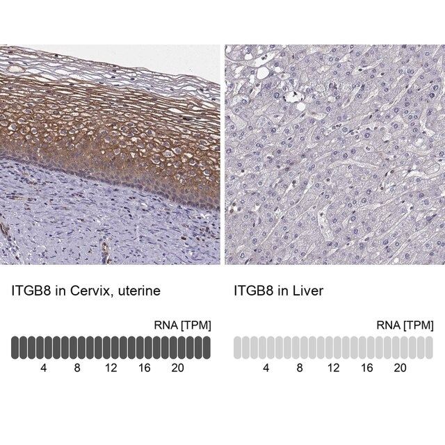 Anti-ITGB8 antibody produced in rabbit