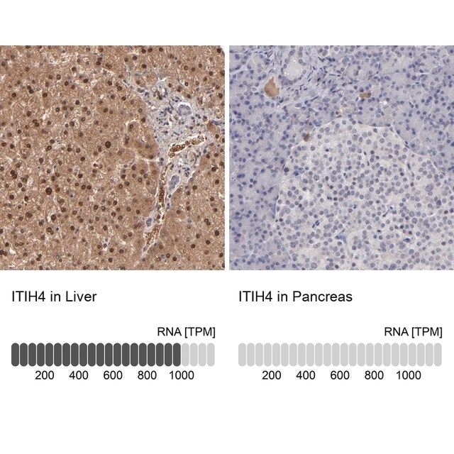 Anti-ITIH4 antibody produced in rabbit