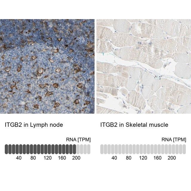 Anti-ITGB2 antibody produced in rabbit