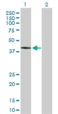 Anti-IVD antibody produced in mouse