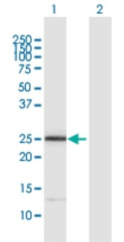 Anti-ITGB1BP3 antibody produced in rabbit