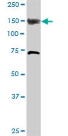 Anti-ITPKB antibody produced in rabbit