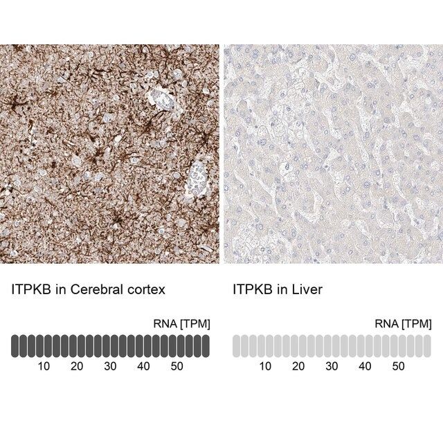 Anti-ITPKB antibody produced in rabbit