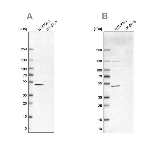 Anti-IST1 antibody produced in rabbit