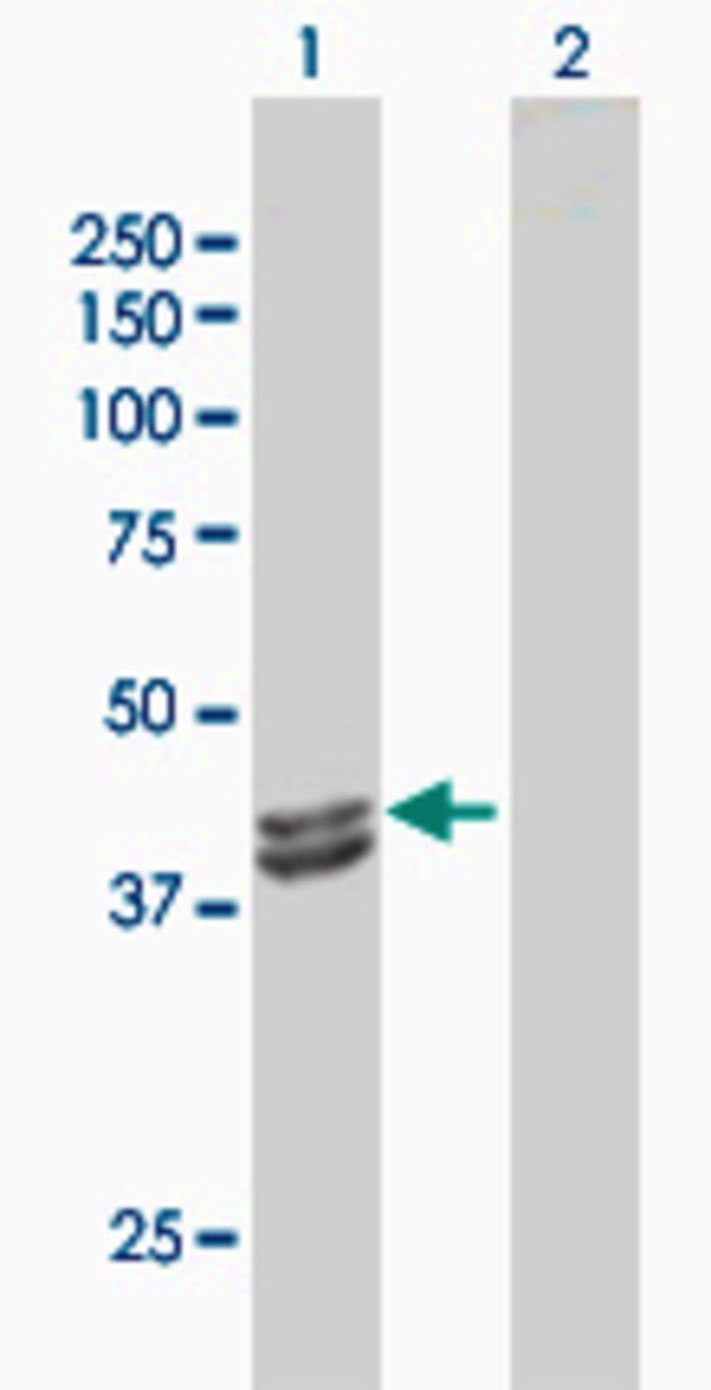 Anti-IVD antibody produced in rabbit