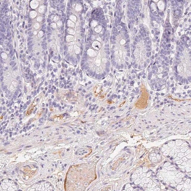 Anti-ITIH2 antibody produced in rabbit