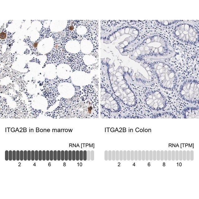 Anti-ITGA2B antibody produced in rabbit