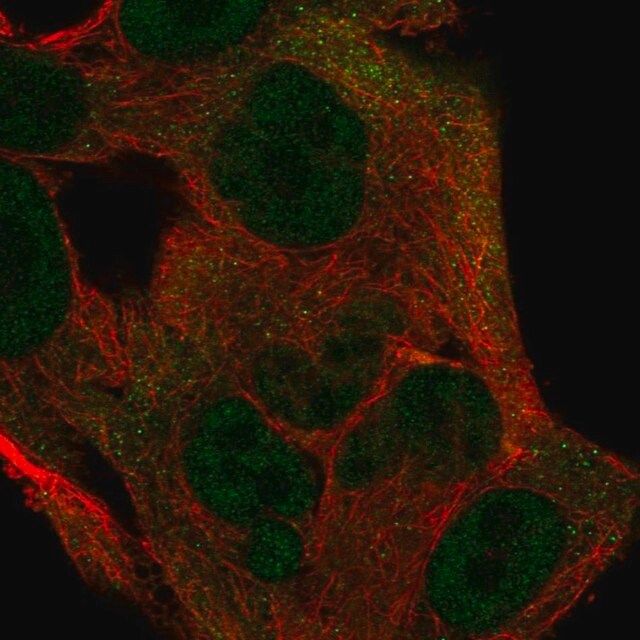 Anti-ITGB1BP1 antibody produced in rabbit