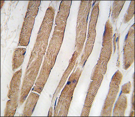 Anti-ITGB1BP3 (N-term) antibody produced in rabbit