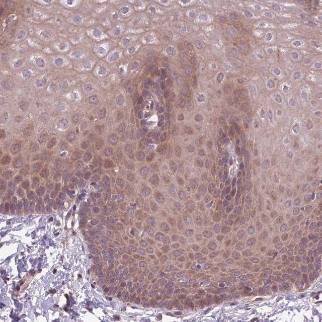 Anti-ITPKC antibody produced in rabbit