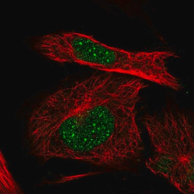 Anti-ITGB1BP1 antibody produced in rabbit