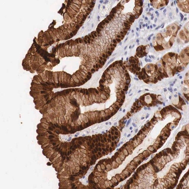 Anti-ITIH6 antibody produced in rabbit