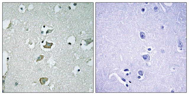 Anti-KCNJ2 antibody produced in rabbit