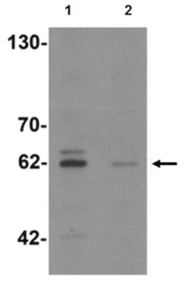 Anti-KCNK13 Antibody