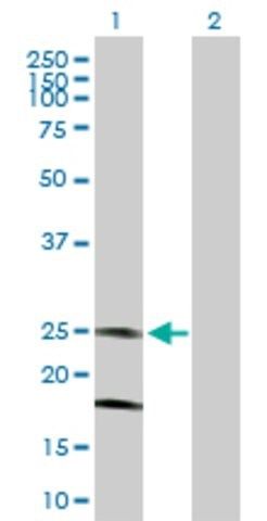 Anti-KCNMB4 antibody produced in mouse