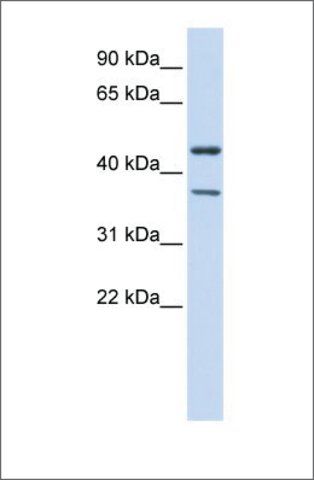 Anti-KCNJ4 antibody produced in rabbit