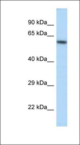 Anti-KCNJ3 antibody produced in rabbit