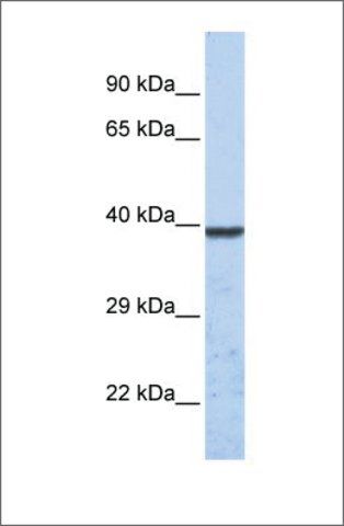 Anti-KCNK1 antibody produced in rabbit