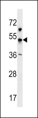 ANTI-KCNJ18(N-TERMINAL) antibody produced in rabbit